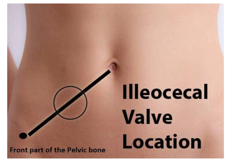 <ul><li><p>How to palpate ICV?</p></li><li><p>What size is it?</p></li><li><p>ICV aligns w what spinal level?</p></li></ul><p></p>