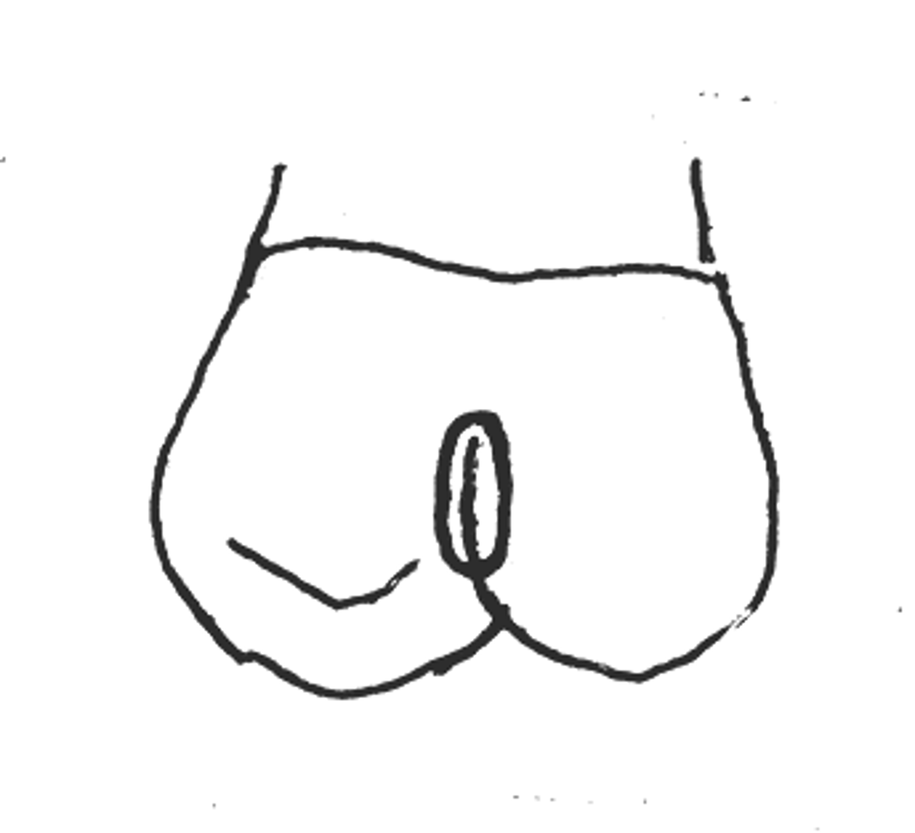 <p>shape = elliptical</p><p>locations = lingual pit</p>