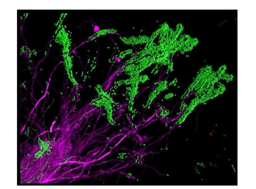<p>What are the green and magenta bacteria called?</p>