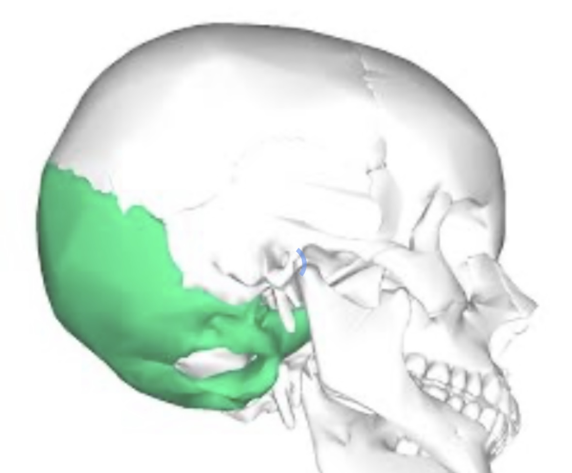 term image