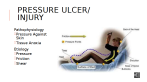 Areas prone to pressure ulcers: Sacrum, heels, elbows, hips, shoulder blades, back of the head, ankles.