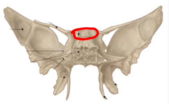 term image