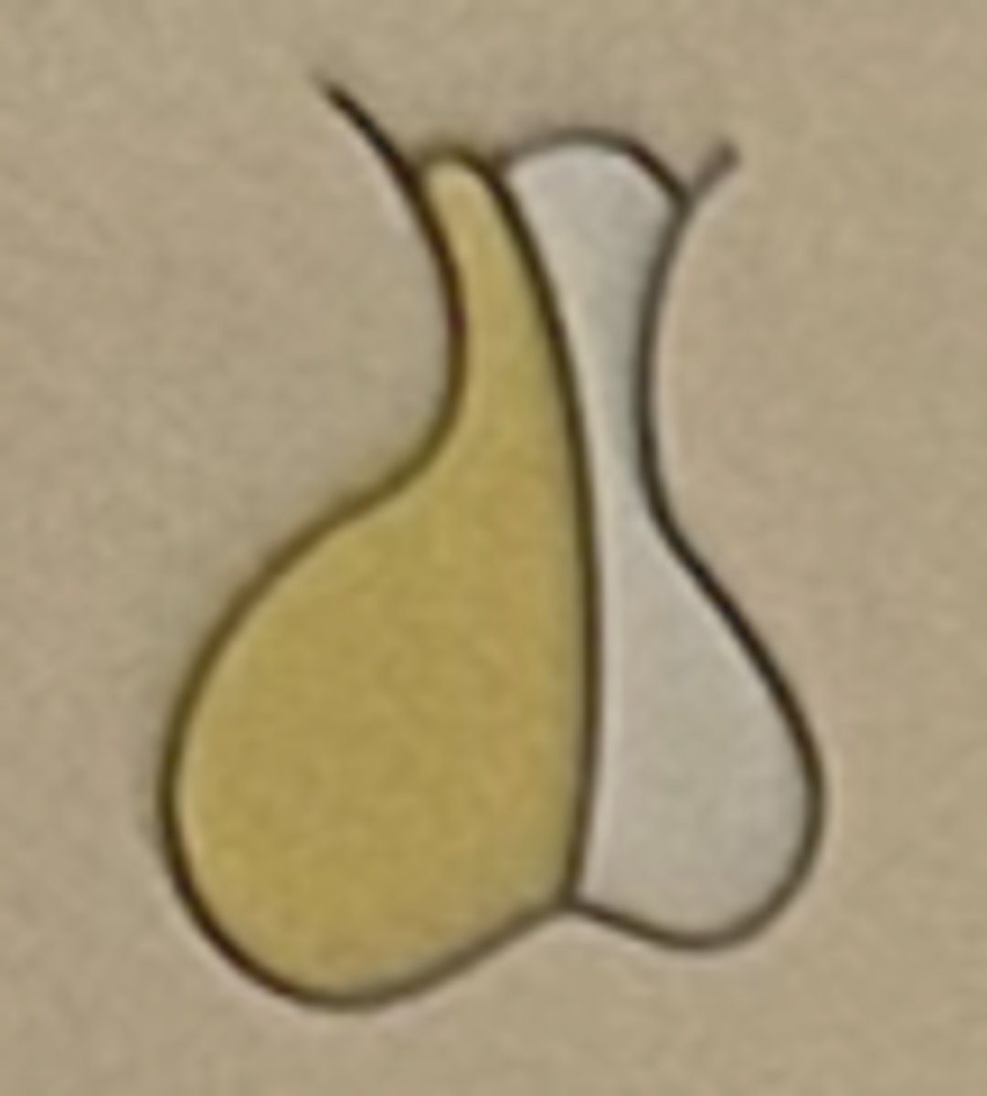 <p>Anterior pituitary (adenohypophysis)</p>