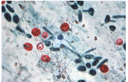 term image
