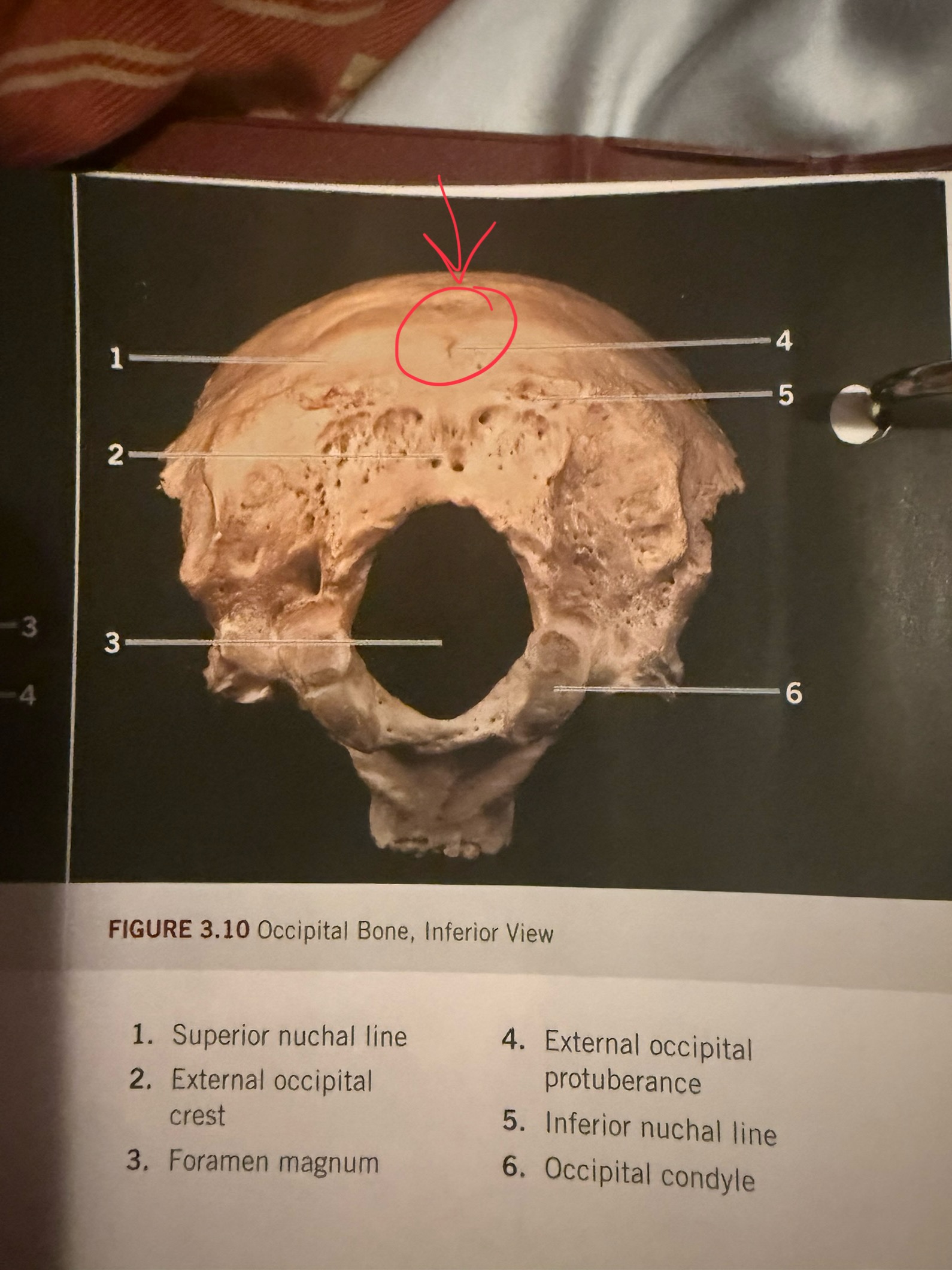 term image
