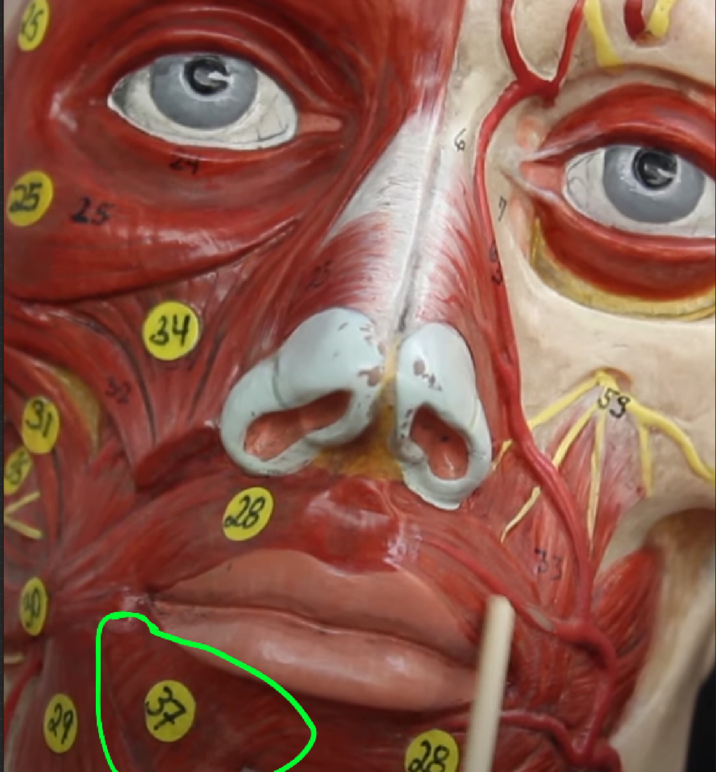 term image