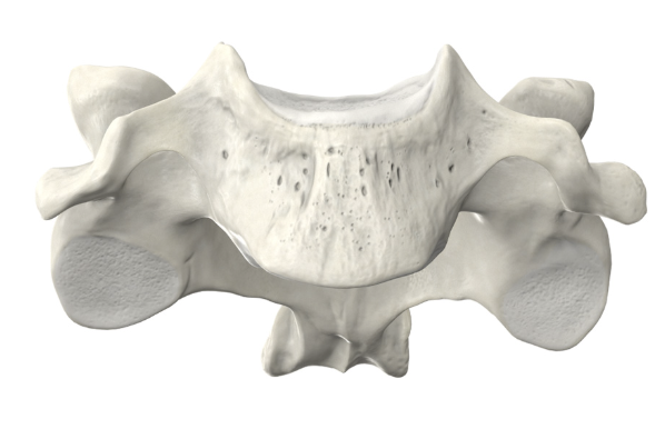 <p>Identify the part of the vertebra (side profile) and explain what diagnostic features helped you reach your conclusion.</p>