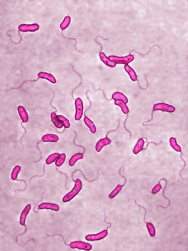 <ol><li><p>Name of bacteria</p></li><li><p>Morphology</p></li></ol>