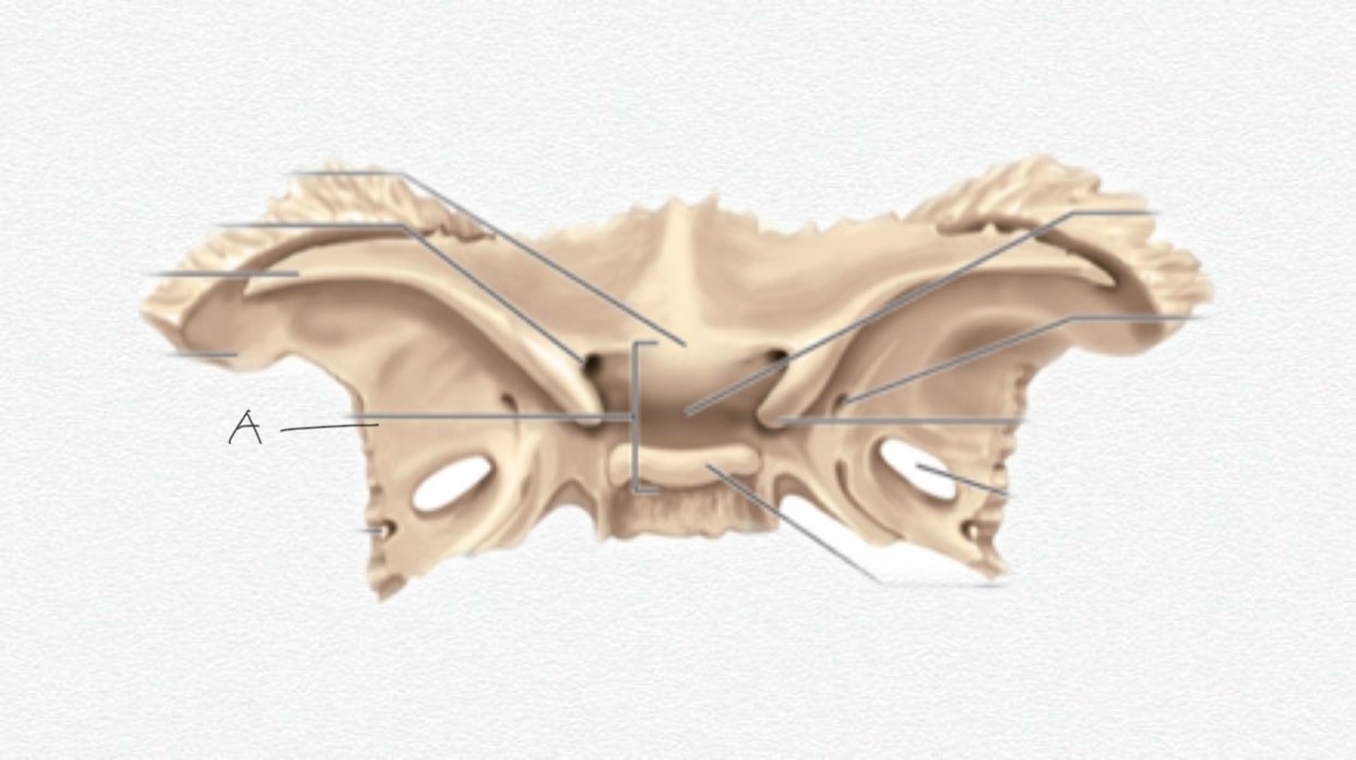 <p>A</p>