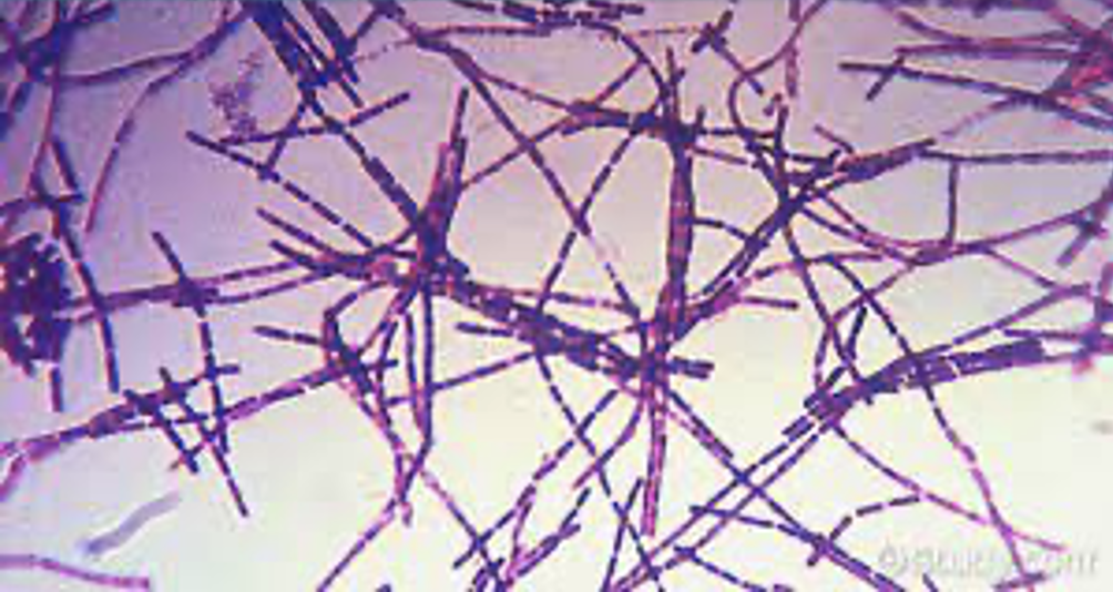 IDENTIFY THE BACTERIA. 