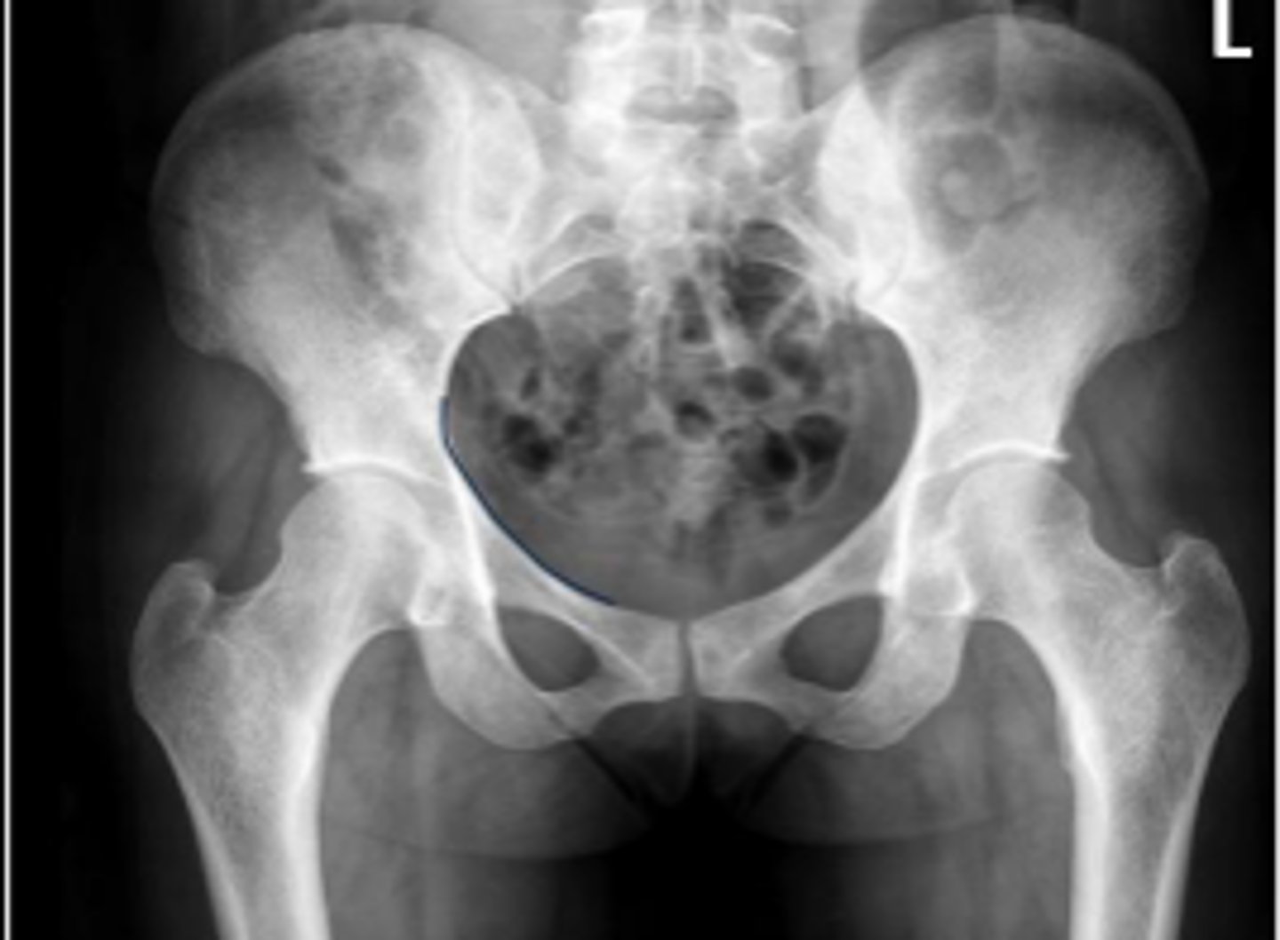 <p>What is the name of the assessment?</p>