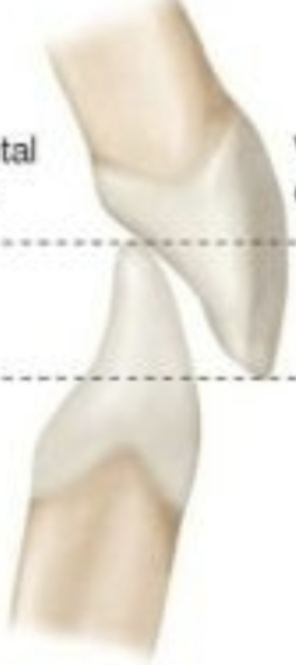 <p>This is an example of </p>