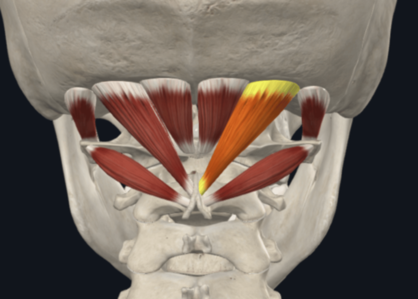 <p>What is the attachment of the Rectus capitis posterior major muscle of the suboccipital muscles?</p>