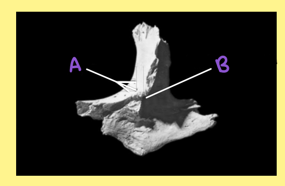 <p><u>Name the following</u>:</p><ul><li><p>Bone?</p></li><li><p>Side?</p></li><li><p>View?</p></li><li><p>A?</p></li></ul><p></p>