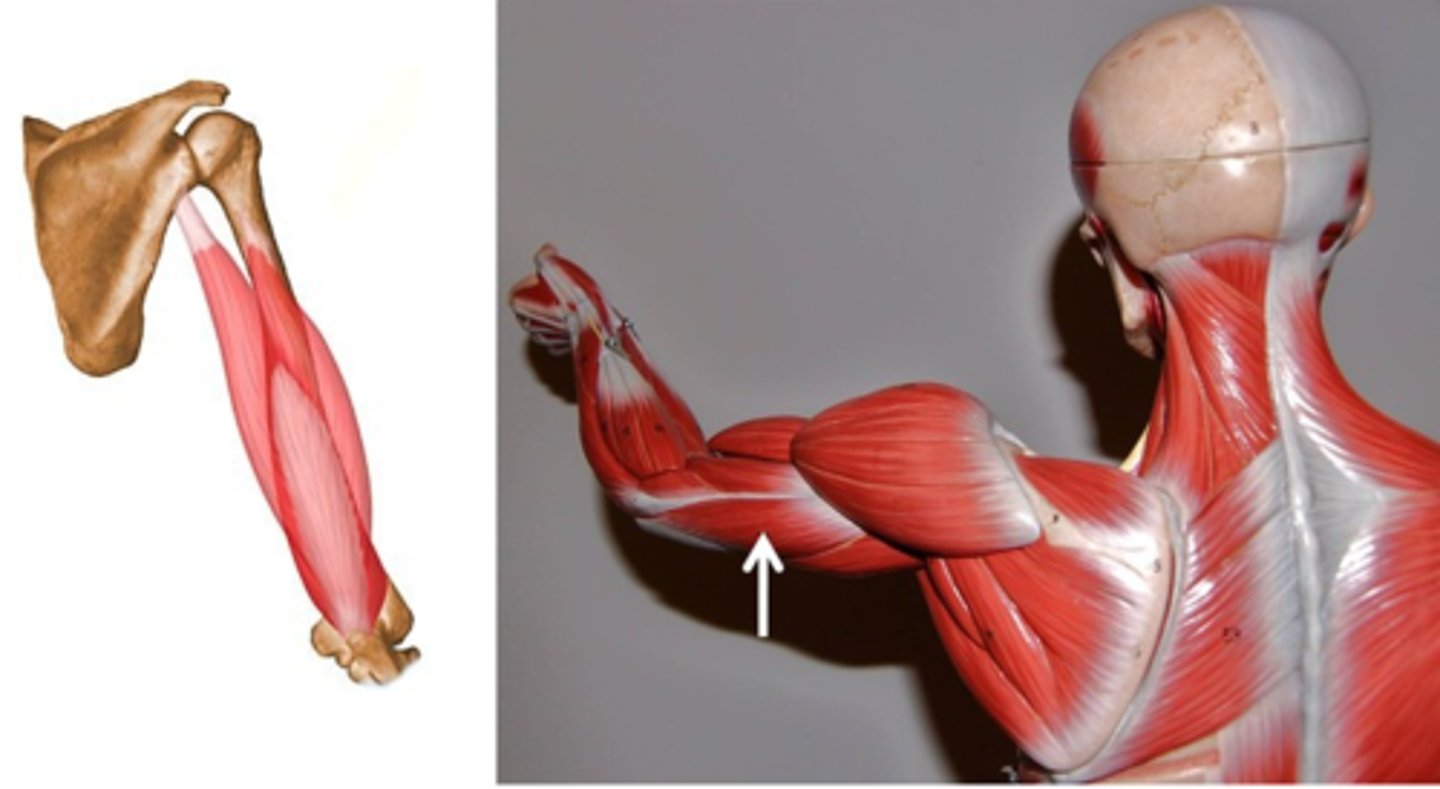 <p>Triceps brachii, lateral head:</p><p>Origin: Proximal Humerus</p><p>Insertion: Olecranon</p><p>Triceps brachii, long head</p><p>Origin: Scapula</p><p>Insertion: Olecranon</p><p>Triceps brachii, medial head</p><p>Origin: Proximal Humerus</p><p>Insertion: Olecranon</p>