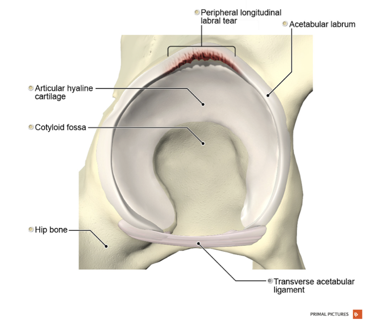 <p>Labral Tear: S/S</p><ul><li><p>What are the 4 main S/S of Labral Tear?</p></li><li><p>What are the 3 most painful positions? </p></li></ul><p></p><p></p>