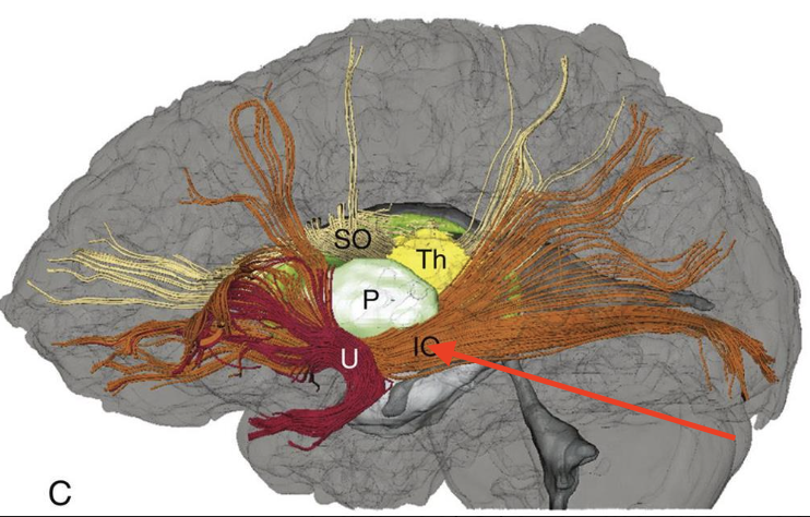 <p>connects frontal and occipital lobe through temporal lobe</p>