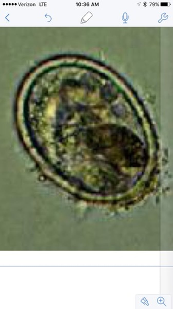 <p>45-70um</p><p>Oval</p>