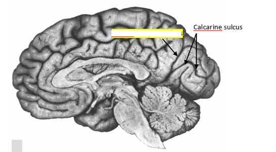 <p>what sulcus is this?</p>
