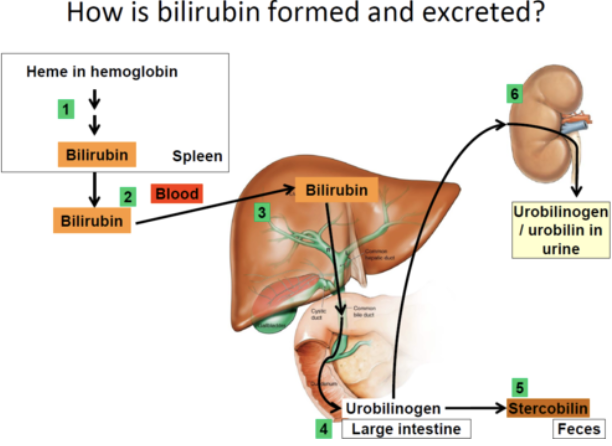<p><strong><em>Yellow-green, alkaline solution containing:&nbsp;</em></strong></p><ol><li><p><strong>Bile salts&nbsp;</strong></p><ul><li><p>Cholesterol derivates that function in fat emulsification and absorption&nbsp;</p></li></ul></li><li><p><strong>Bilirubin&nbsp;</strong></p><ul><li><p>Pigment formed from heme&nbsp;</p></li></ul></li><li><p><strong>Cholesterol&nbsp;</strong></p></li><li><p><strong>Triglycerides&nbsp;</strong></p></li><li><p><strong>Phospholipids&nbsp;</strong></p></li><li><p><strong>Electrolytes&nbsp;</strong></p></li></ol><p></p>