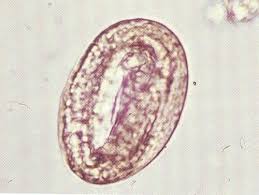 <p>Metastrongylus elongatus</p>