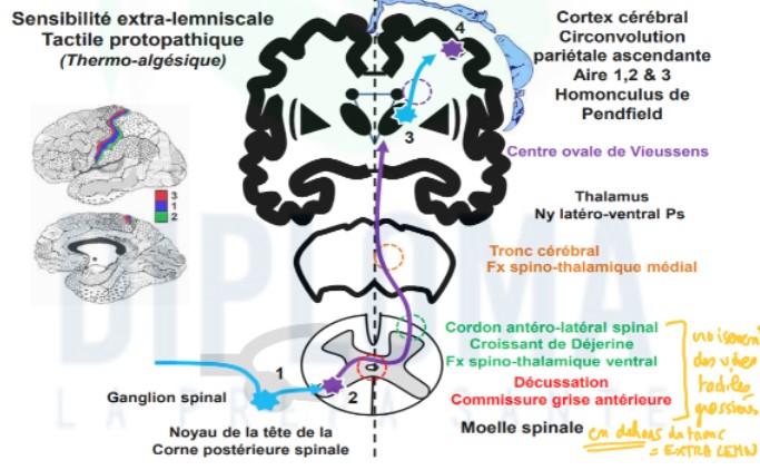 <ul><li><p>1er neurone ne s&apos;articule pas avec le 2e au niv du TC mais au nv de la corne dorsale de la ME</p></li><li><p>2e neurone : remonte ds cordon antéro-latéral de la moelle après avoir traversé ligne med → thalamus</p></li><li><p>décussation a lieu au niv de la commissure grise de la moelle</p></li><li><p>dans le cordon antéro-latéral : fibres forment faisceau spino-thalamique ventral</p></li><li><p>ds TC ; fibres empruntent faisceau spino-thalamique médial (≠ du Ruban de Reil)</p></li><li><p>3e neurone idem que sensibilité lemniscale</p></li></ul>