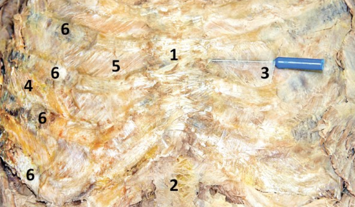 <p>The most medial part of the external intercostal m. that is a semi-transparent membrane (directly superficial to the internal intercostal m.) - Include number in diagram</p>