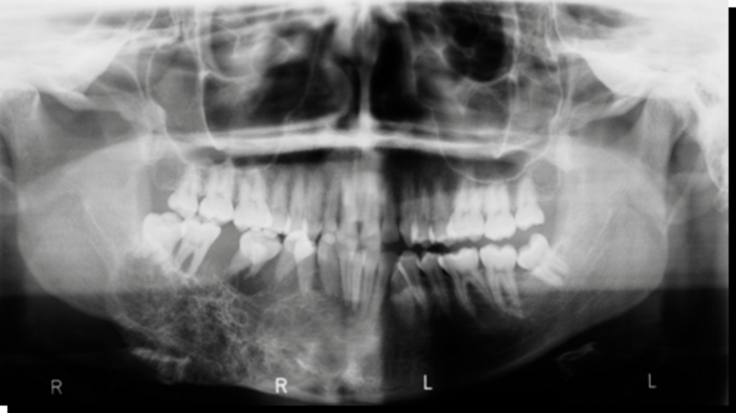 <p>ID the pathology:</p>