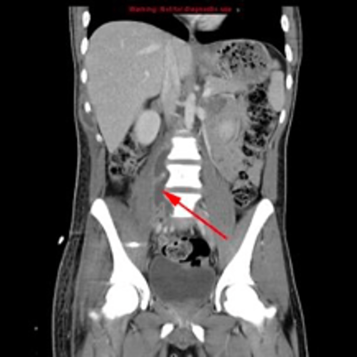 <p><em>identify the pathology</em> </p>