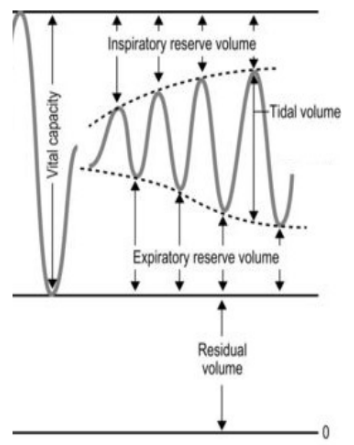 <ul><li><p>increasing TV</p></li><li><p>decreasing reserve volumes (both IRV and ERV)</p></li><li><p>what was previously “reserve” is now being used as part of tidal volume</p></li><li><p>these changes dont really affect much else - no change in RV, TLC, or VC</p></li></ul><p></p>