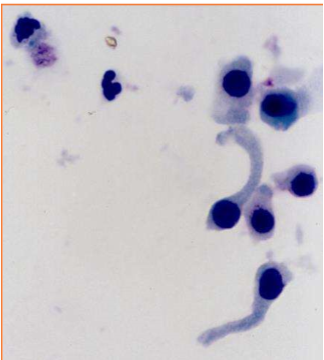 <p>These cells are present on sediment evaluation. What are they?</p>