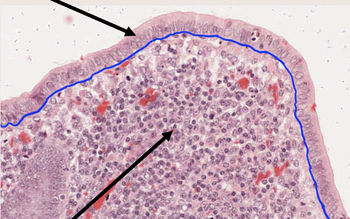 <p>Basement membrane (the blue line thinger)</p>