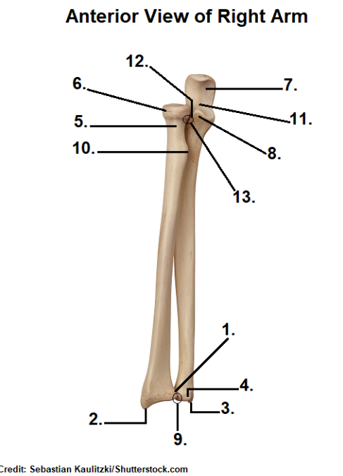<p><span>What is the name of the part labeled #3?</span></p>