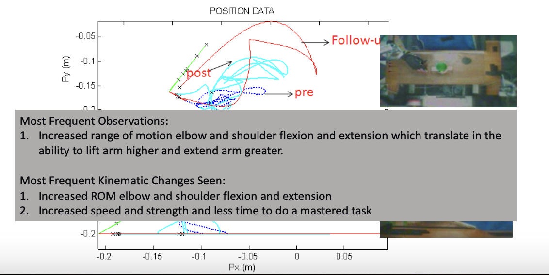 <p>tested Adler with patients; after 4 weeks of interacting with the system, 3x/week for ~1hr</p><p>== system can promote recovery and reduction in impairment for a drinking task (i.e., as a result of the treatment, the person was able to move across the table + move out of the plane a little bit better) </p><p>Most Frequent Observations: </p><ul><li><p>1. Increased range of motion of the elbow and shoulder flexion and extension, which translates into the ability to lift the arm higher and extend the arm further</p></li></ul><p>Most Frequent Kinematic Changes Seen: </p><ul><li><p>1. Increased ROM of the elbow and shoulder flexion and extension </p></li><li><p>2. Increased speed and strength, and less time to do a mastered task</p></li></ul><p></p>
