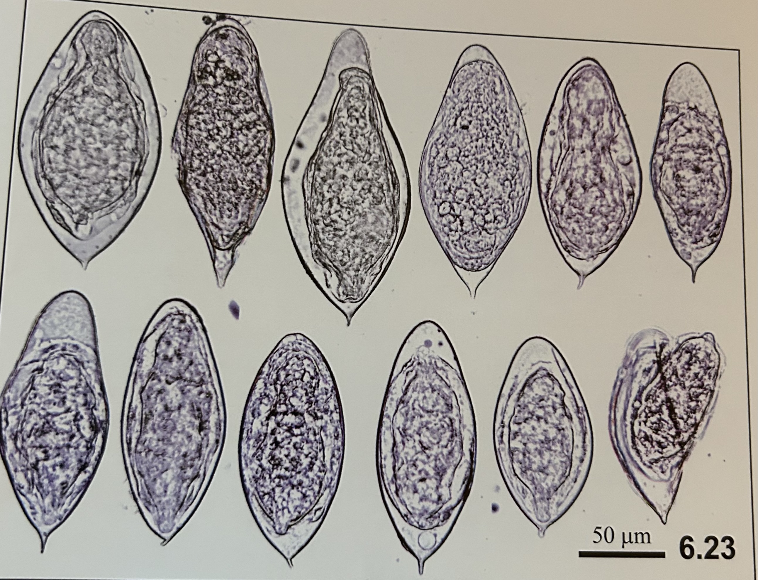 <p>structures of Schistosoma haematobium (eggs)?</p>