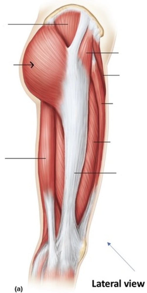 <p>What muscle is this?</p>