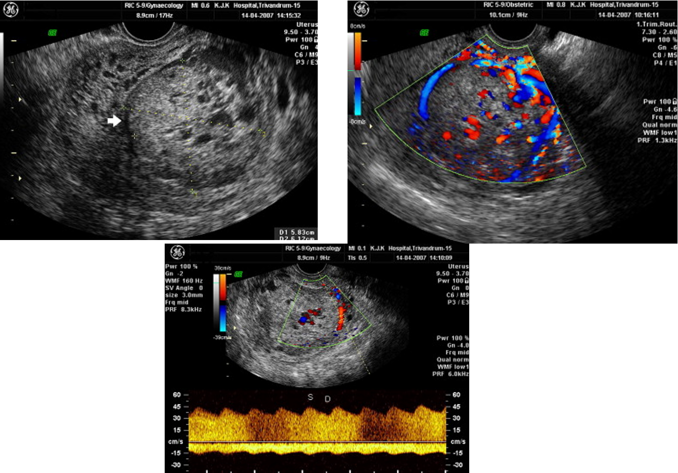 <p>what pathology is this?</p>