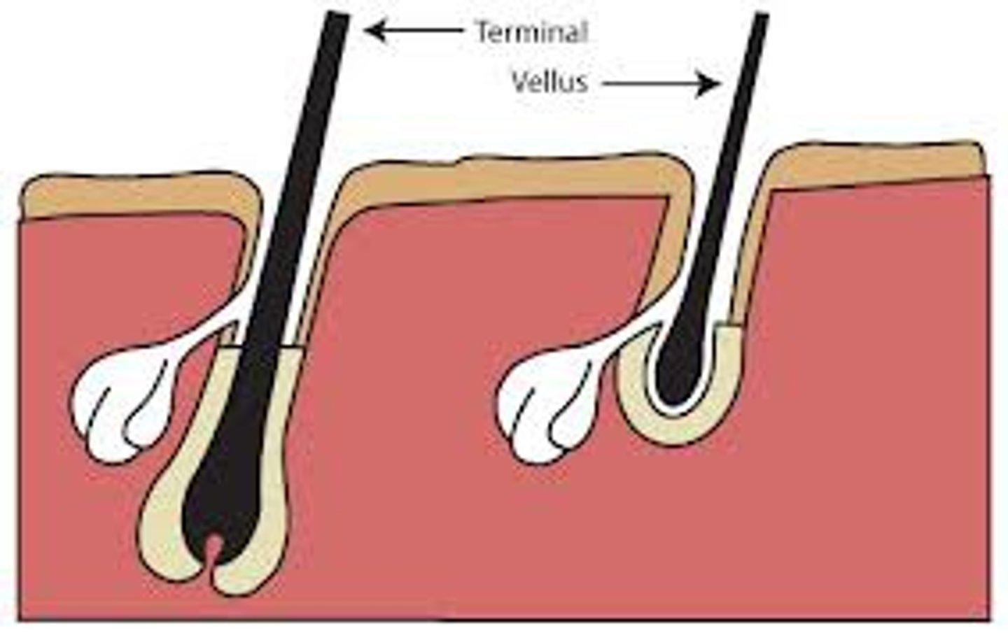 <p>long,coarse, pigmented hair found on the scalp, legs, arms, and bodies of males and females.</p>
