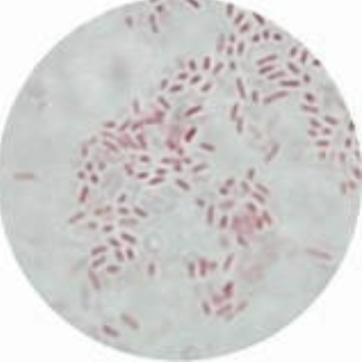 Gram stained slides of…