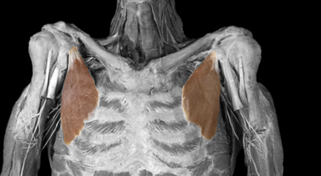 <p>What muscle is this? </p>