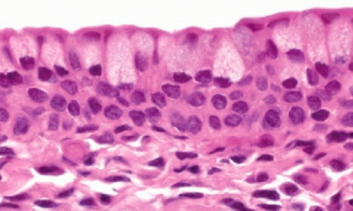 <ul><li><p>2-3 layers of columnar cells</p></li><li><p>posterior side of eyelid, in contact with surface of eyeball</p></li></ul><p></p>