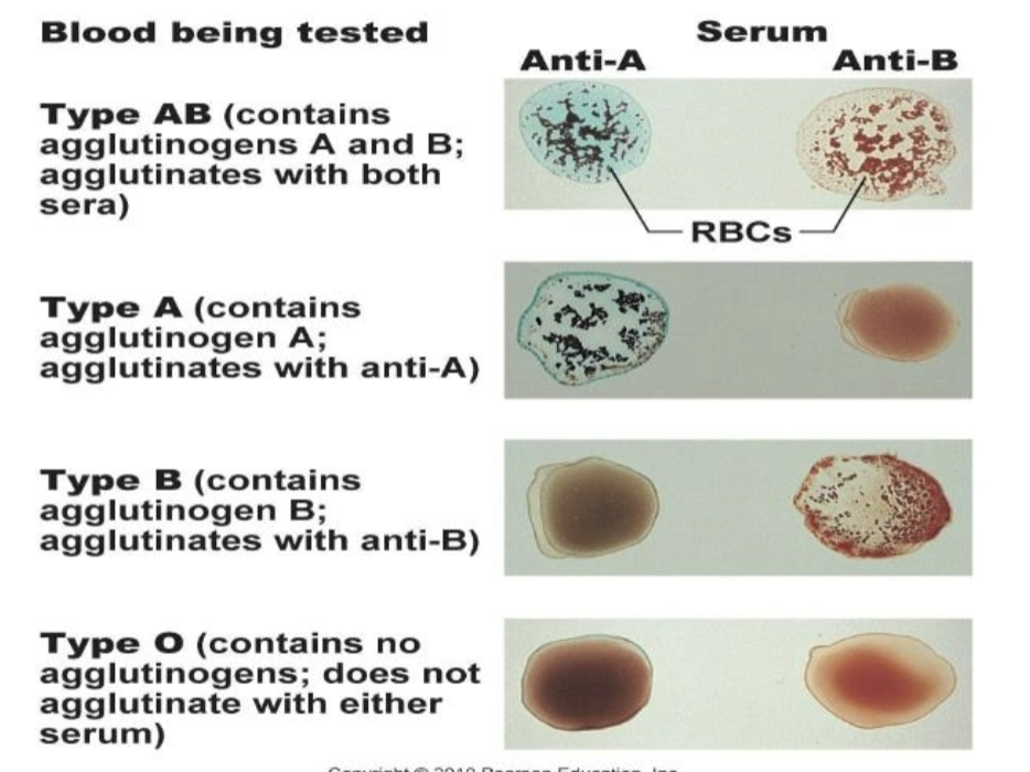 Serological testing 

* Antibody–antigen reaction 


* Shows up as clotting 