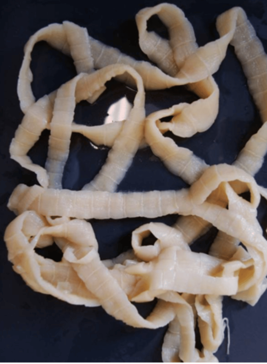 <p>Found in a pig with poor weight gain. What is this parasite?</p>