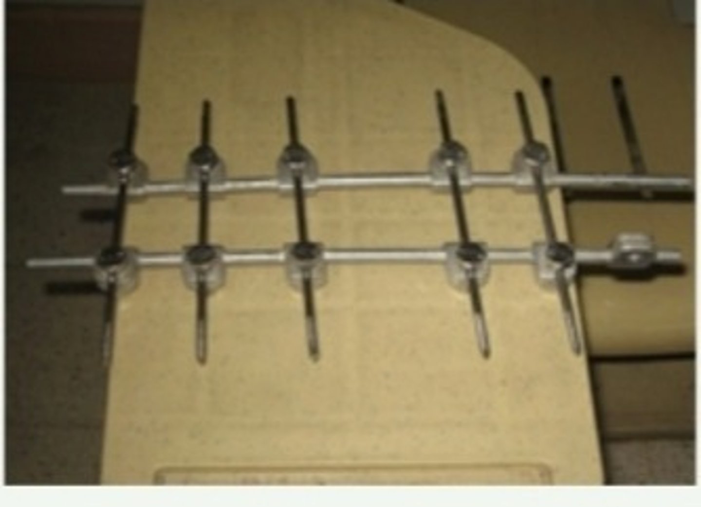 <p>commimuted facture of femur</p>