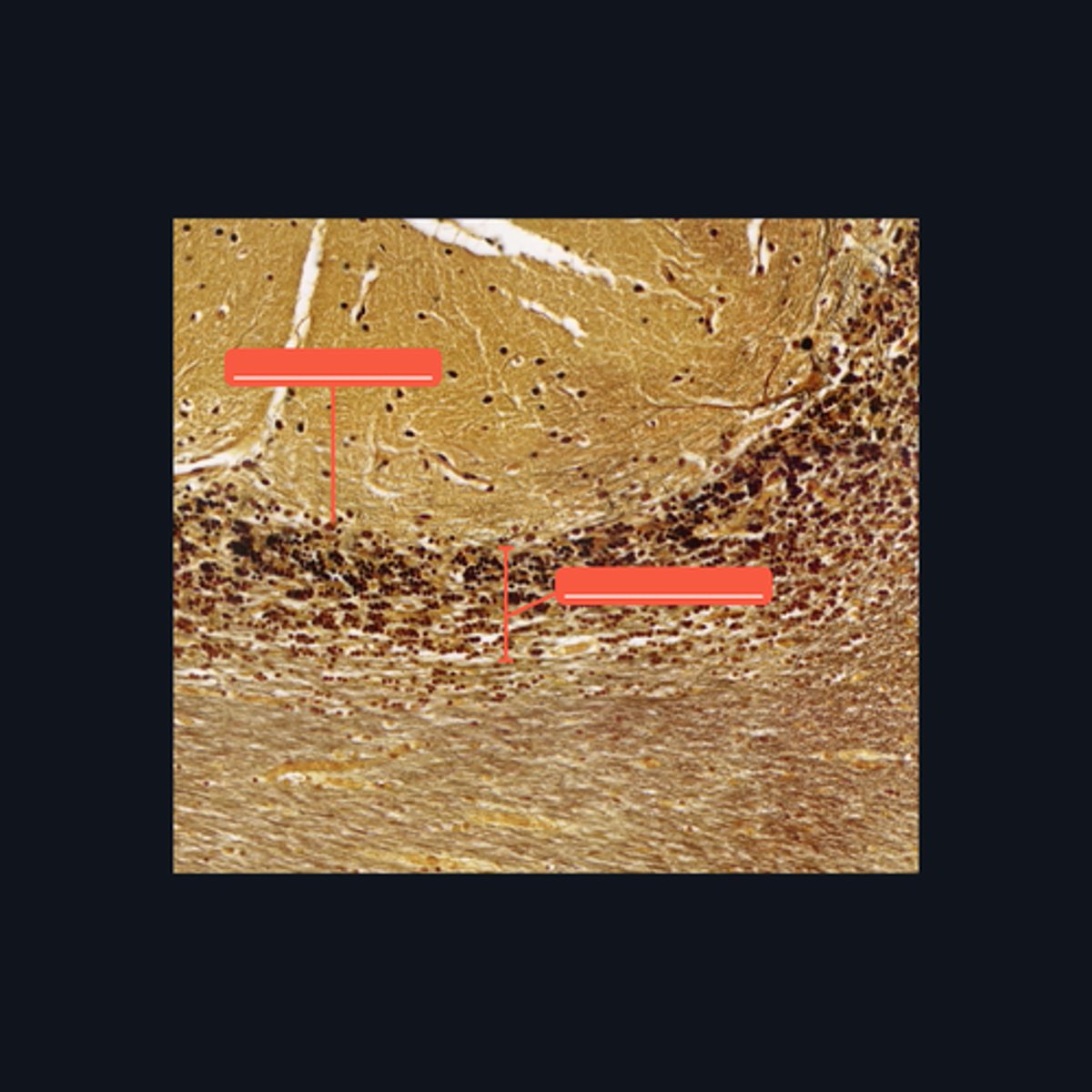 <p>The layer is densely populated by small, round to oval neurons called _____.</p>