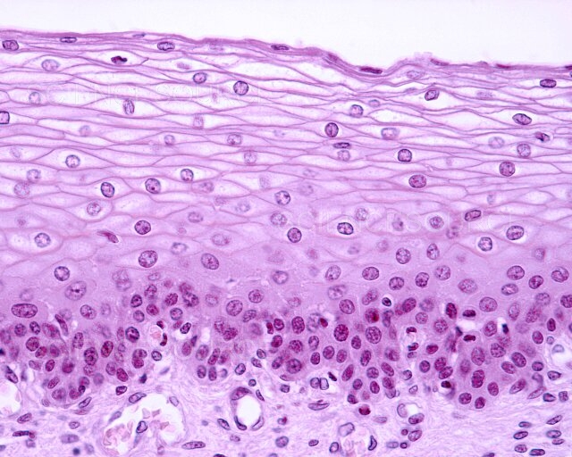 <p>What type of epithelial tissue is this?</p>