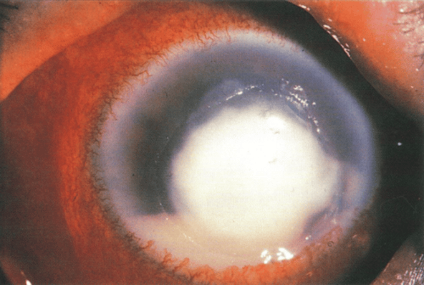 <p>Should we culture this lesion shown here?</p>