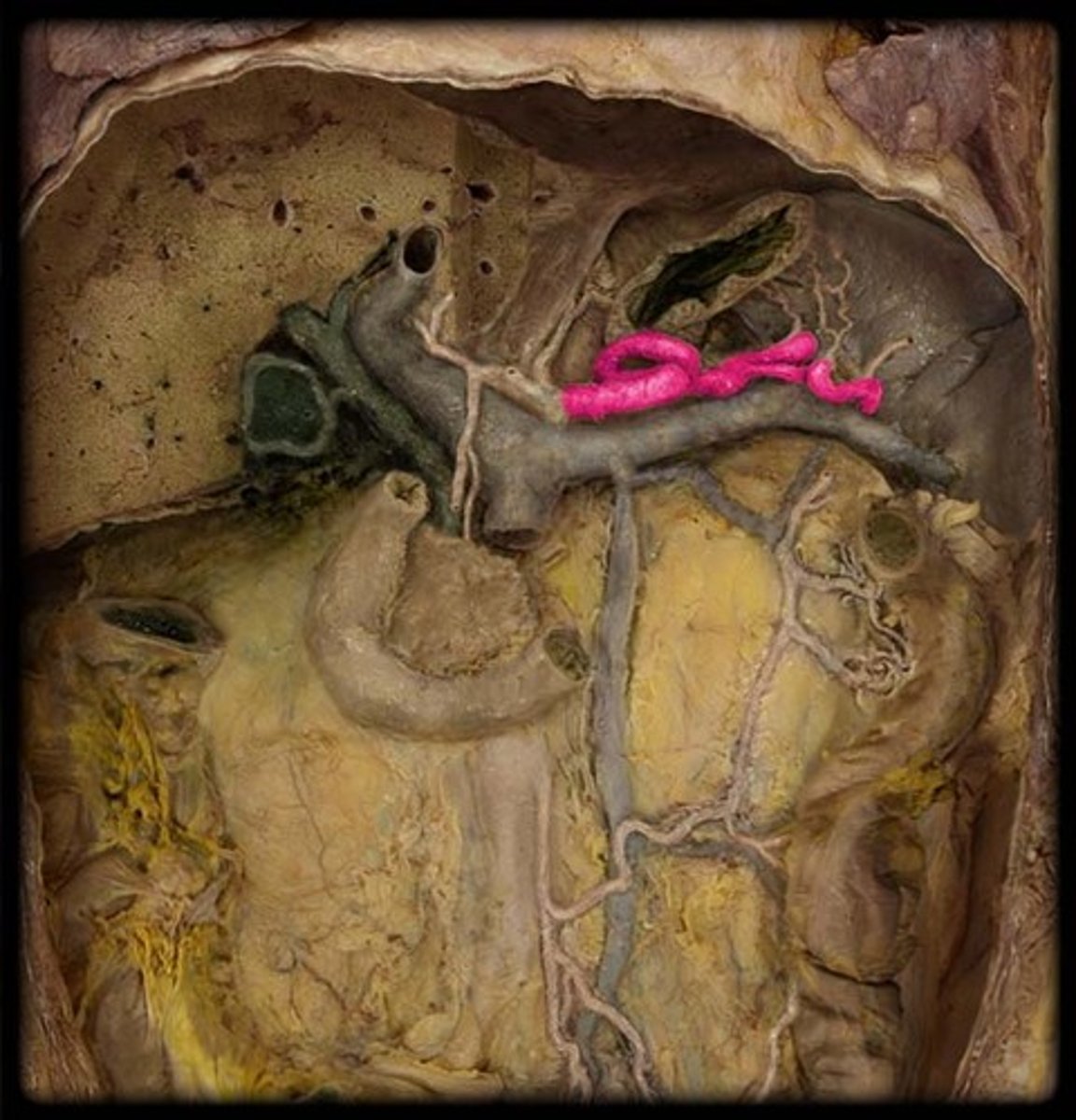 <p>What is this?</p>