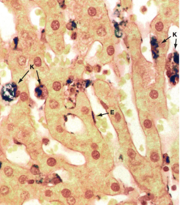 <ul><li><p>Large intercellular gaps</p></li><li><p>Large fenestrations (no diaphragms)</p></li><li><p>Discontinuous basement membrane </p></li><li><p>Diameter = 30 - 40um: liver, bone marrow, spleen.</p></li></ul><p></p>