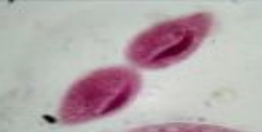 <p>What is the name of this organism?</p>